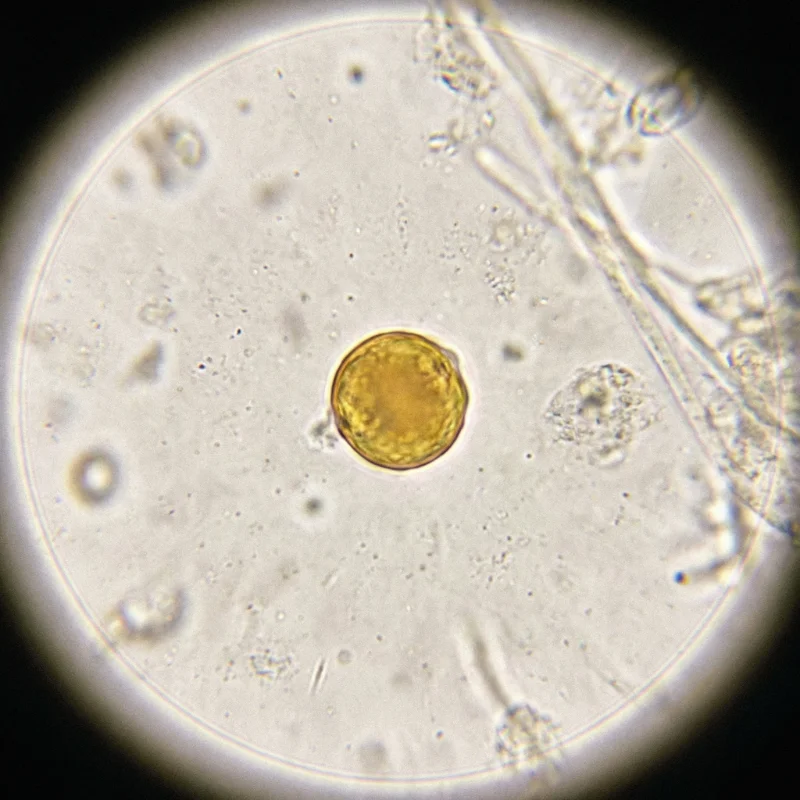 Staphylococcus aureus (Staphylococcus aureus)